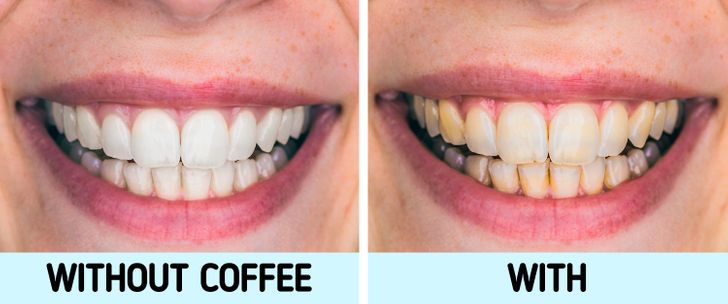 تاثیر خوردن قهوه بر دندان ها