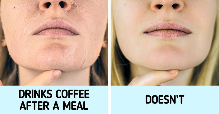 عوارض خوردن قهوه بر خشکی پوست